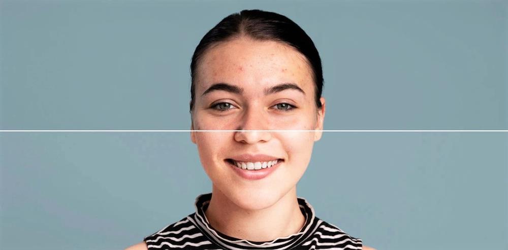 اسپری ضد آفتاب روشن کننده پوست